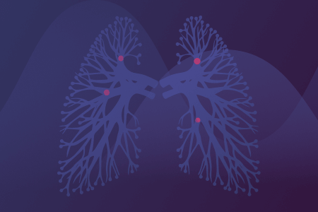 Smart App for pulmonarу embolism